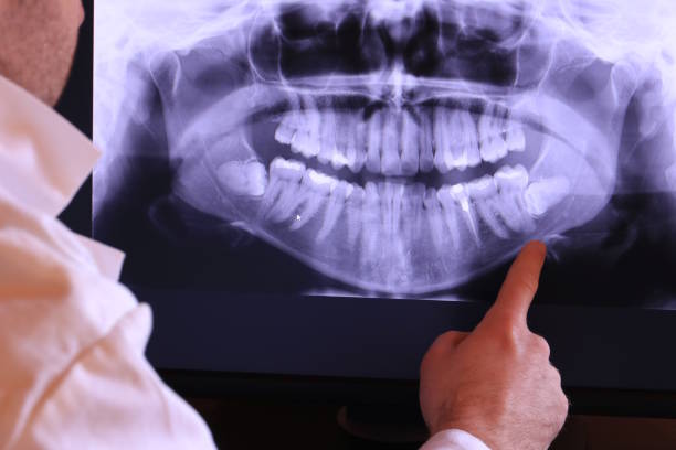 Best Walk-In Emergency Dentist in Maryland City, MD